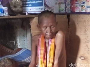 Pasien Sakit Parah di Bima Diduga Dipulangkan Puskesmas karena Tak Punya KTP