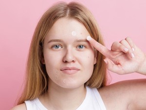 Waspada 5 Kesalahan Penggunaan Acne Patch, Malah Bikin Jerawat Makin Parah