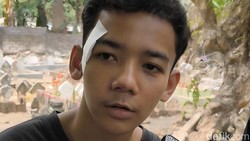 Kesaksian Fahmi Selamat dari Pembacokan di Jalan Udayana: Saya Pasrah